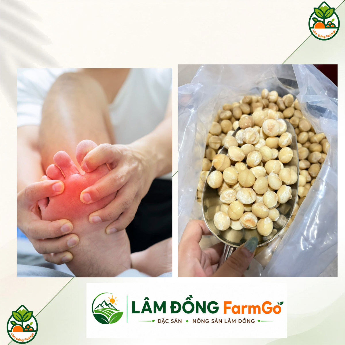 Người Bị Bệnh Gút Có Ăn Được Hạt Mắc Ca Không?
